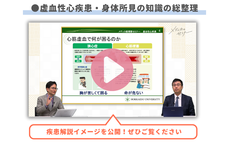 虚血性心疾患・身体所見の知識の総整理