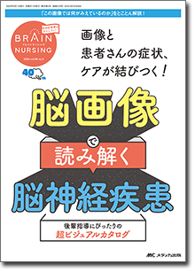 BRAIN NURSING（ブレインナーシング）2024年5号