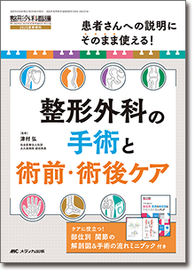 整形外科の手術と術前・術後ケア