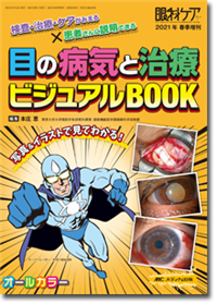 目の病気と治療 ビジュアルBOOK