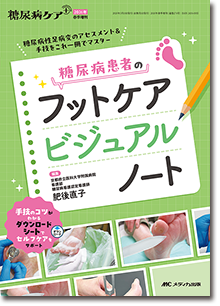 糖尿病患者のフットケアビジュアルノート