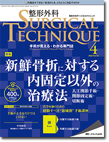 整形外科 SURGICAL TECHNIQUE（整形外科サージカルテクニック）2022年4号