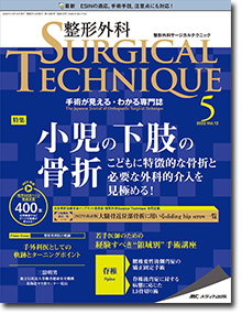 整形外科 SURGICAL TECHNIQUE（整形外科サージカルテクニック）2022年5号