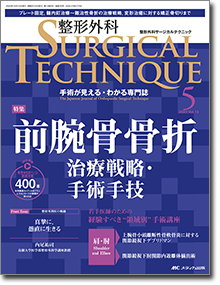 整形外科 SURGICAL TECHNIQUE（サージカルテクニック）2023年5号