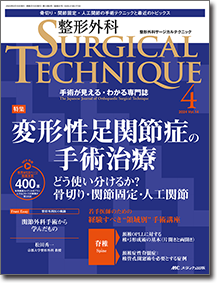 整形外科 SURGICAL TECHNIQUE（サージカルテクニック）2024年4号