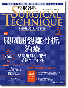 整形外科 SURGICAL TECHNIQUE（サージカルテクニック）2024年5号