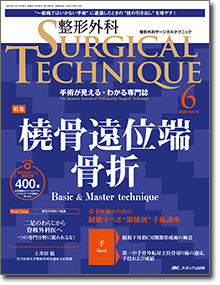 整形外科 SURGICAL TECHNIQUE（サージカルテクニック）2024年6号