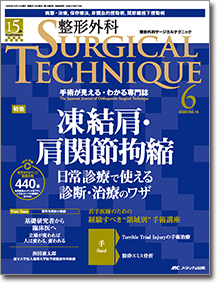 整形外科 SURGICAL TECHNIQUE（サージカルテクニック）2025年6号
