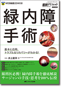 緑内障手術