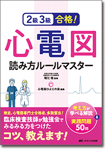 ２級３級合格！心電図読み方ルールマスター