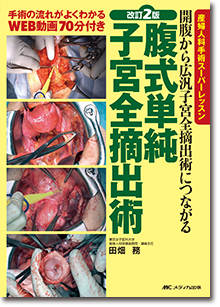 改訂2版　腹式単純子宮全摘出術