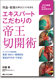エキスパートこだわりの帝王切開術
