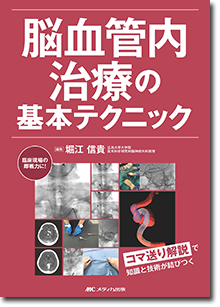 脳血管内治療の基本テクニック