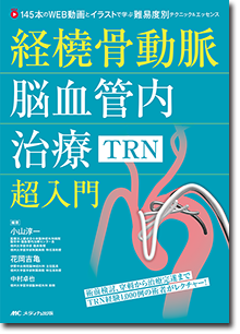 経橈骨動脈脳血管内治療（TRN）超入門