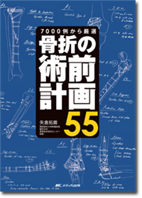 骨折の術前計画55 | オンラインストア｜看護・医学新刊・セミナー 