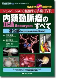 内頚動脈瘤（ICA Aneurysm）のすべて－近位部（cavernous-paraclinoid）