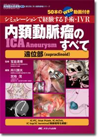 内頚動脈瘤（ICA Aneurysm）のすべて－遠位部（supraclinoid）