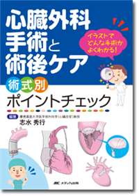 心臓外科手術と術後ケア 術式別ポイントチェック | オンライン