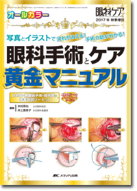 みんなで学ぶ眼科の手術: スタッフだって知っておかなきゃ! これ1冊で