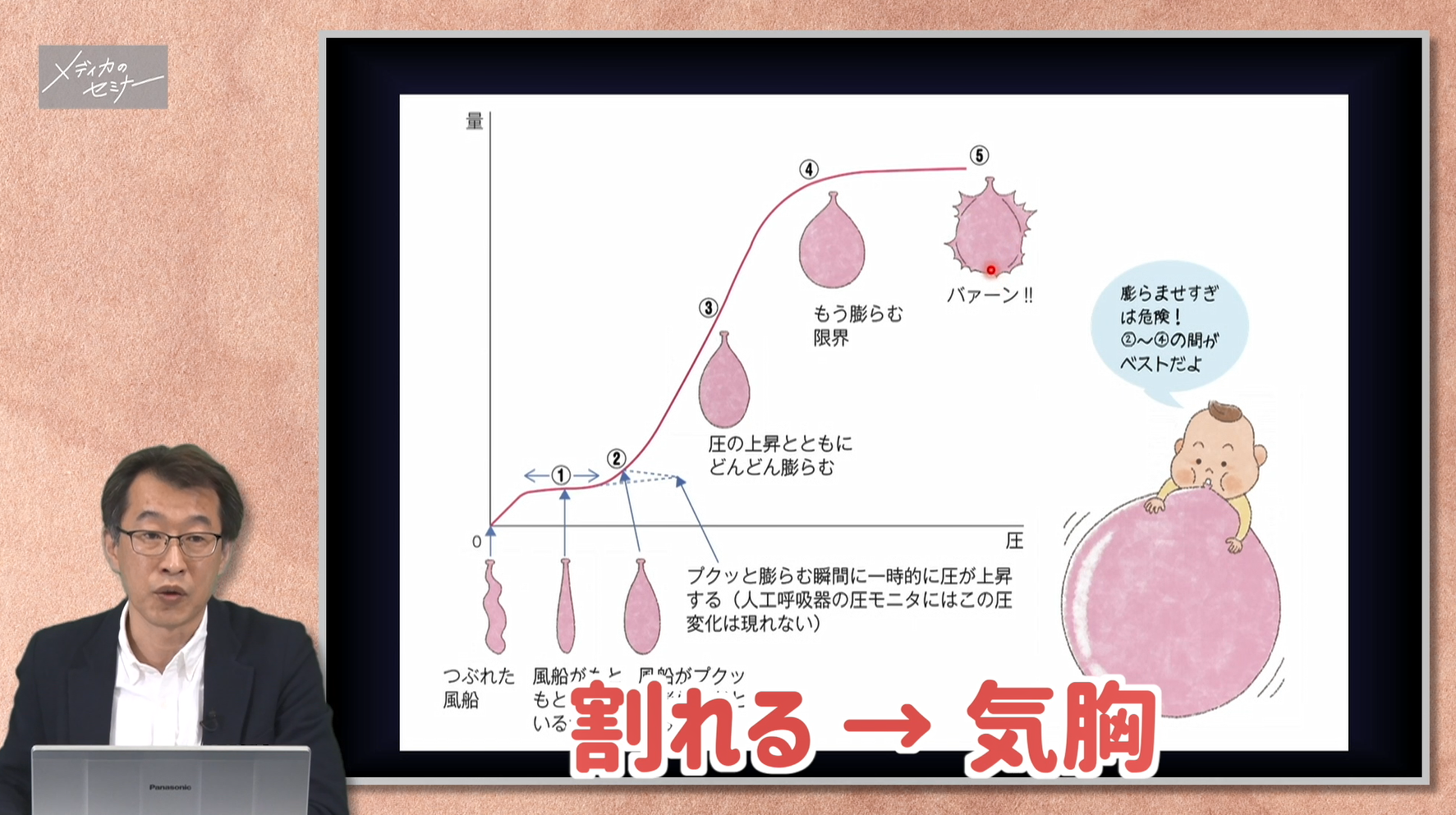 新生児 小児の呼吸管理のきほん スライド資料ダウンロード版 オンラインストア メディカ出版