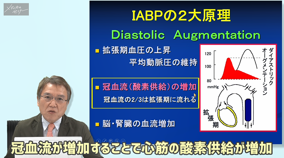 根拠がわかる！なぜ？なに？補助循環 ＜IABP編＞　【スライド資料送付】