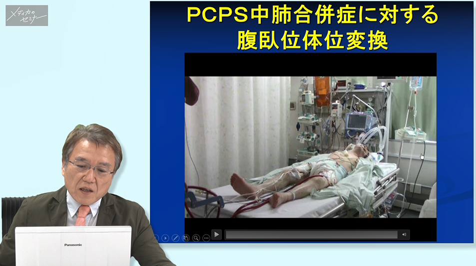 根拠がわかる！なぜ？なに？補助循環 ＜PCPS編＞　【スライド資料ダウンロード】