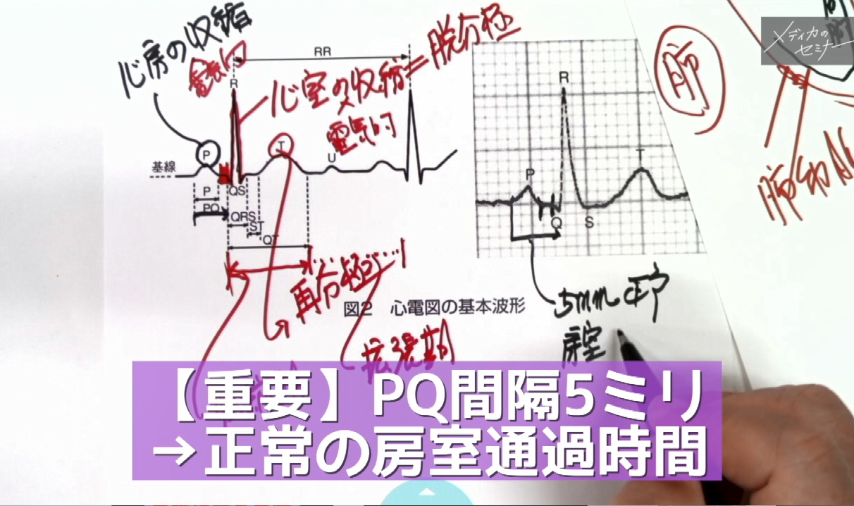 明日からすぐに役立つ心電図の読み方　【スライド資料送付】