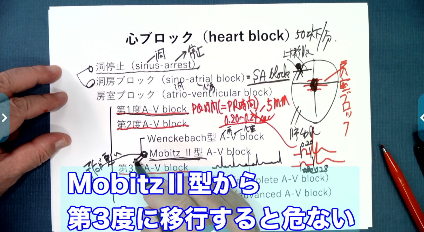 明日からすぐに役立つ心電図の読み方 ＜不整脈編＞　【スライド資料ダウンロード】
