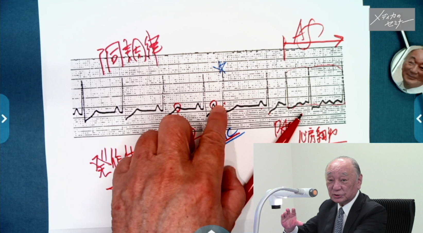 明日からすぐに役立つ心電図の読み方 ＜不整脈編＞　【スライド資料ダウンロード】
