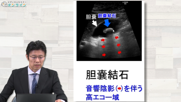 胆道・膵臓の解剖・疾患・治療の知識　【スライド資料ダウンロード】