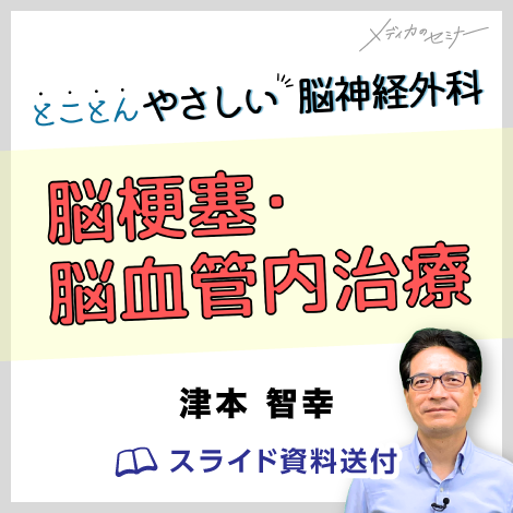 とことんやさしい脳神経外科 〈 脳梗塞・脳血管内治療 〉　【スライド資料送付】