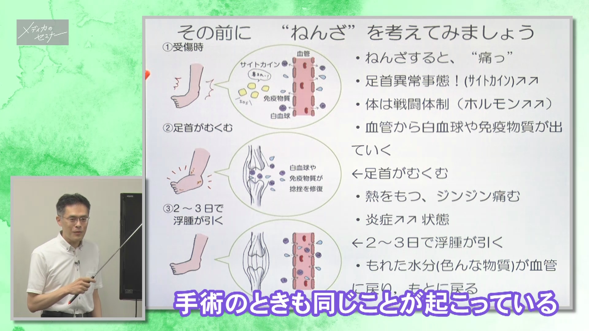 消化器外科 術後観察ポイント これだけ編　【スライド資料ダウンロード】