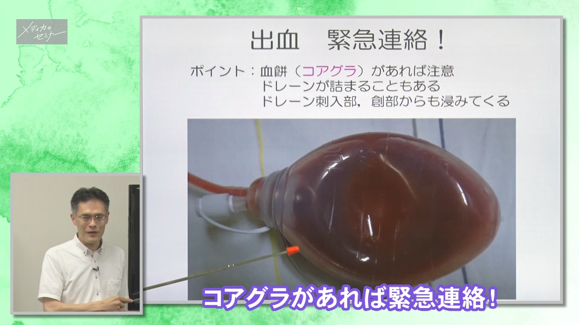 消化器外科 術後観察ポイント これだけ編　【スライド資料ダウンロード】