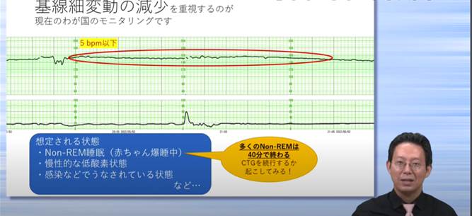 新人助産師のための妊産褥婦のケアとCTGの基本 これだけ！　【スライド資料送付】