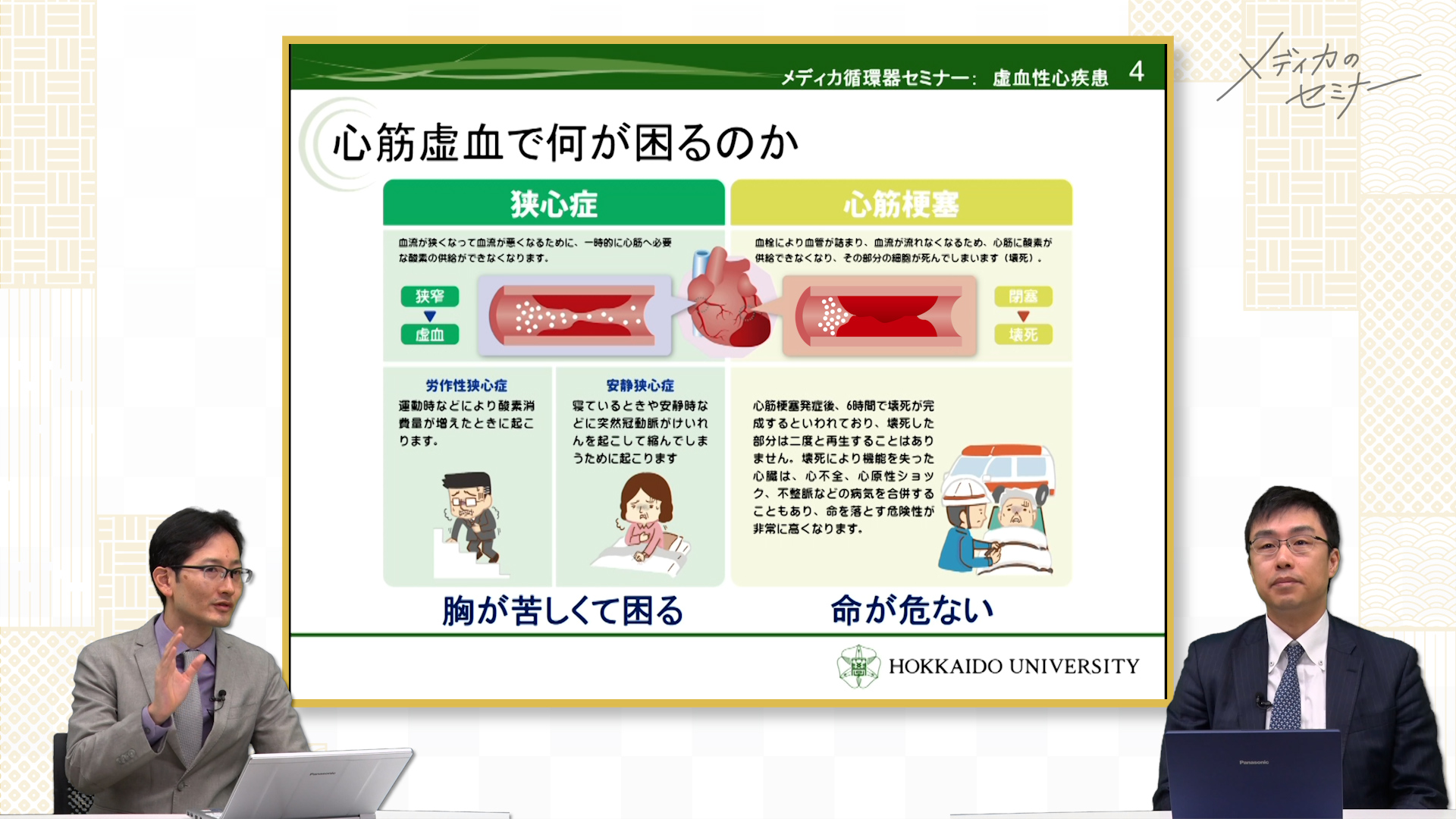 虚血性心疾患・身体所見の知識の総整理　【スライド資料送付】