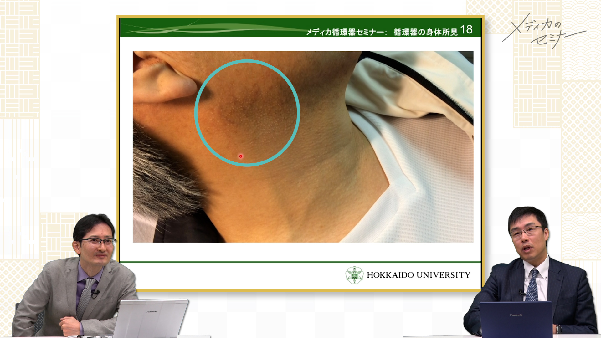 虚血性心疾患・身体所見の知識の総整理　【スライド資料送付】