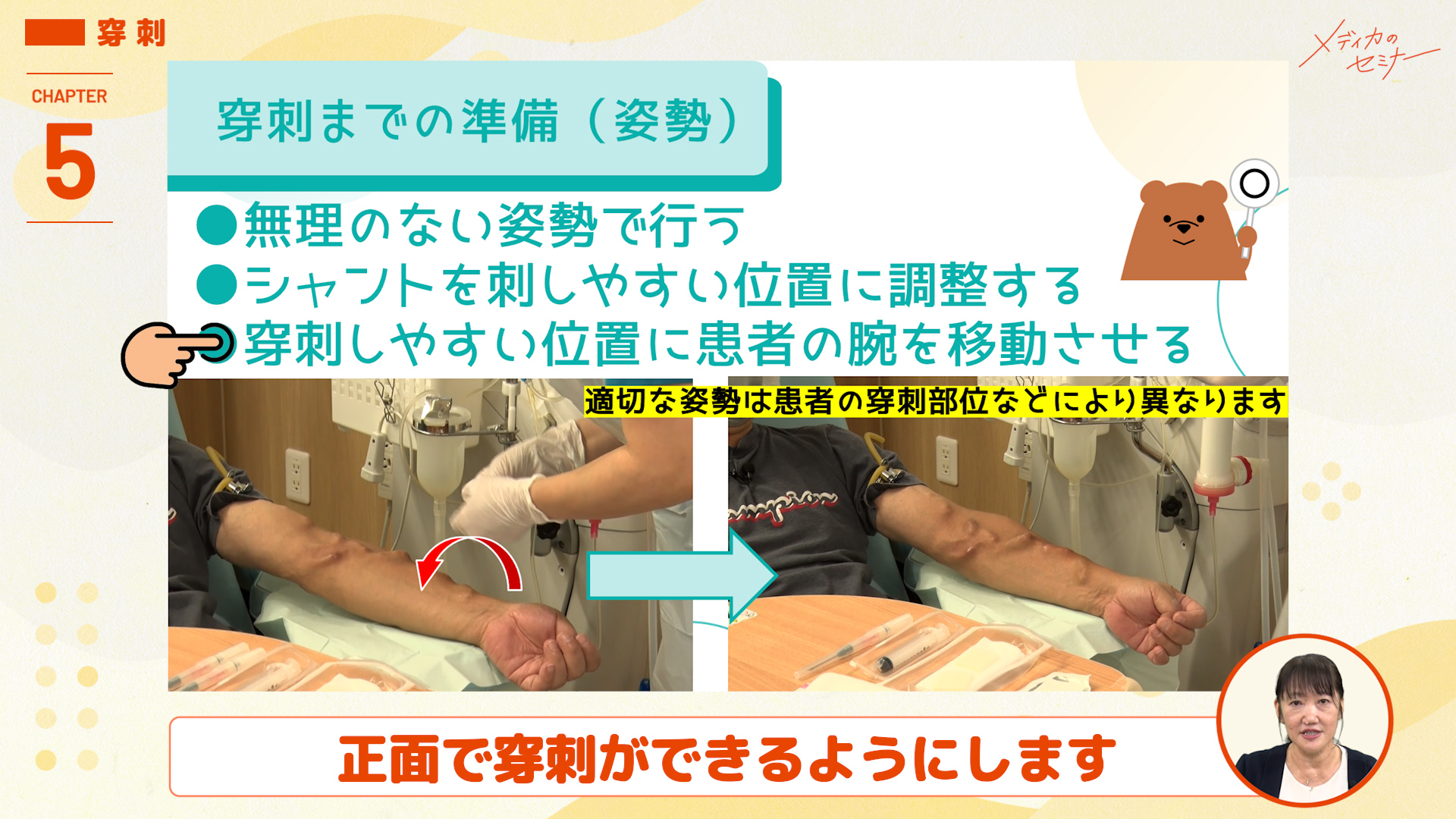 実演して解説！ 看護師の透析手技（穿刺シーンあり）　【スライド資料送付】