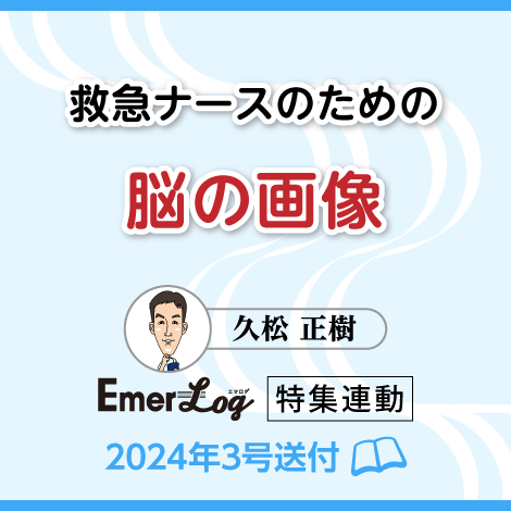 救急ナースのための脳の画像　【エマログ24年3号付】