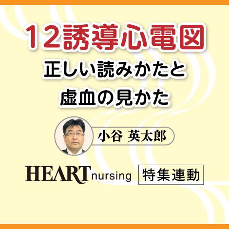 12誘導心電図 正しい読みかたと虚血の見かた