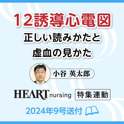 12誘導心電図 正しい読みかたと虚血の見かた　【ハートナーシング24年9号付】