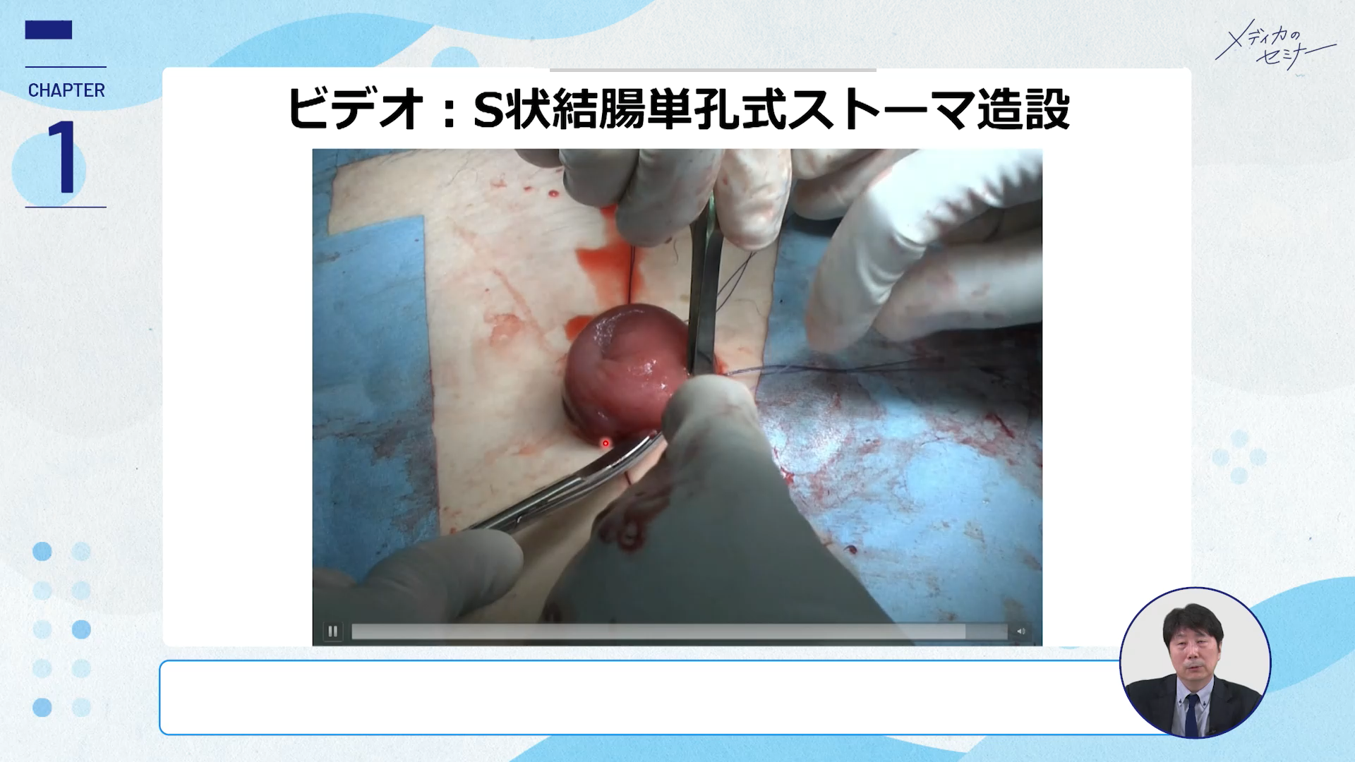 ナースのためのストーマ講座　【スライド資料送付】