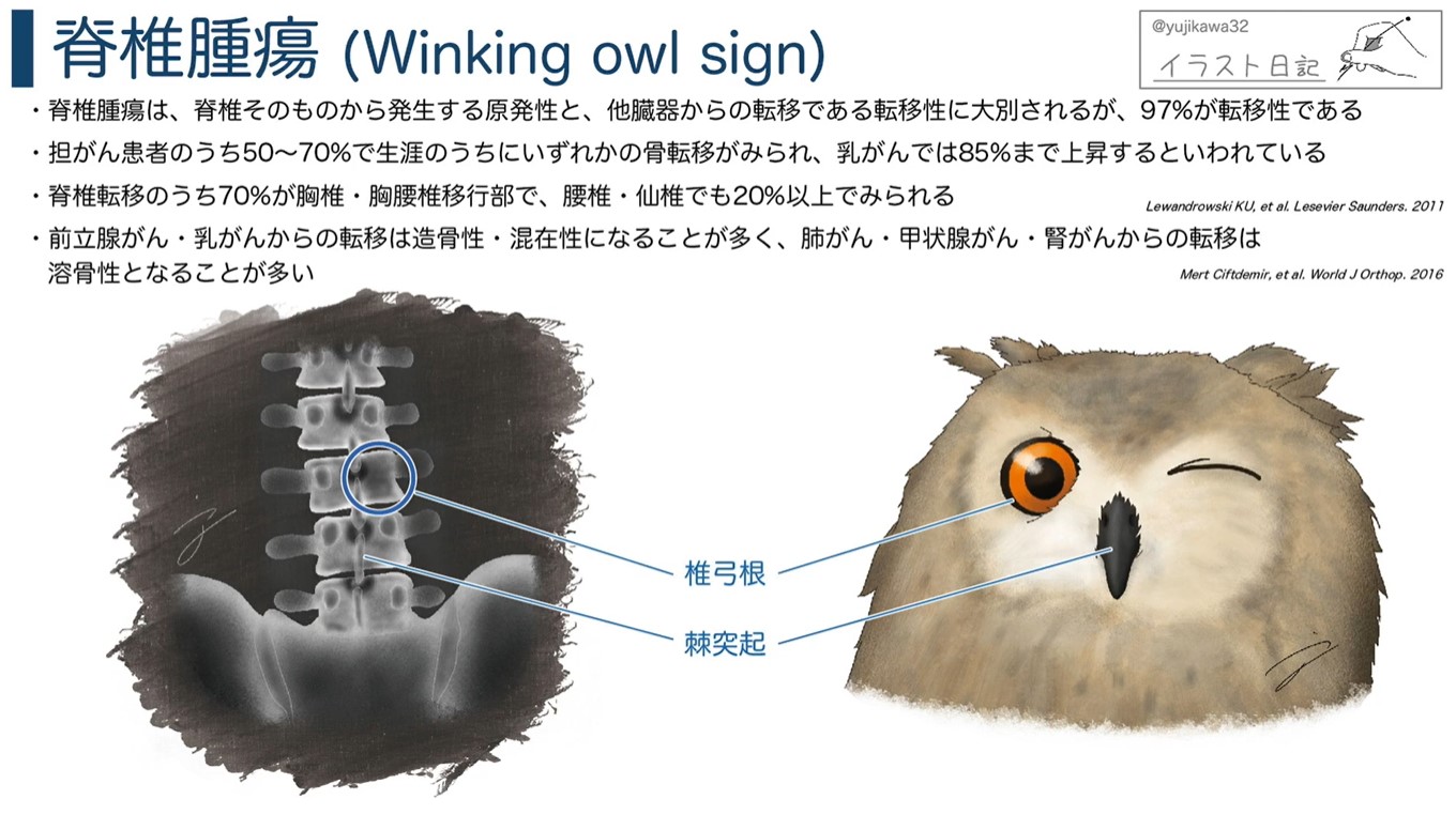 耳と目で学ぶオーディオスライド「Dr.ユジカワの美しい解剖・疾患イラスト」