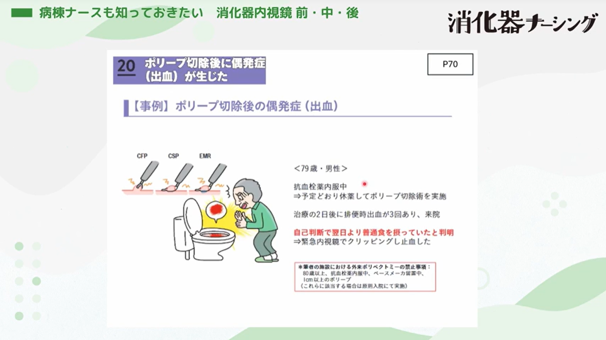 病棟ナースも知っておきたい　消化器内視鏡 前・中・後　【消化器ナーシング25年9号付】