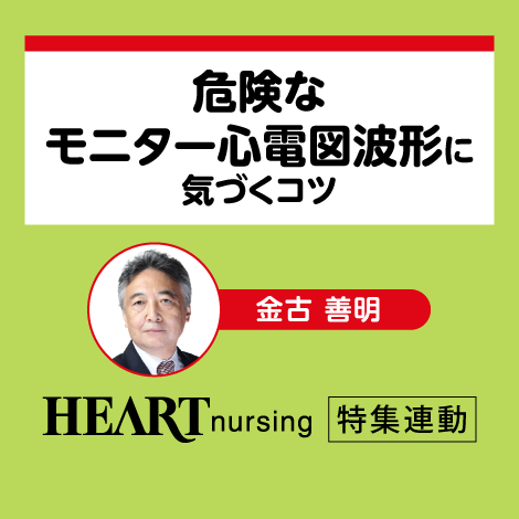 危険なモニター心電図波形に気づくコツ