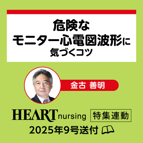危険なモニター心電図波形に気づくコツ 【ハートナーシング25年9号付】