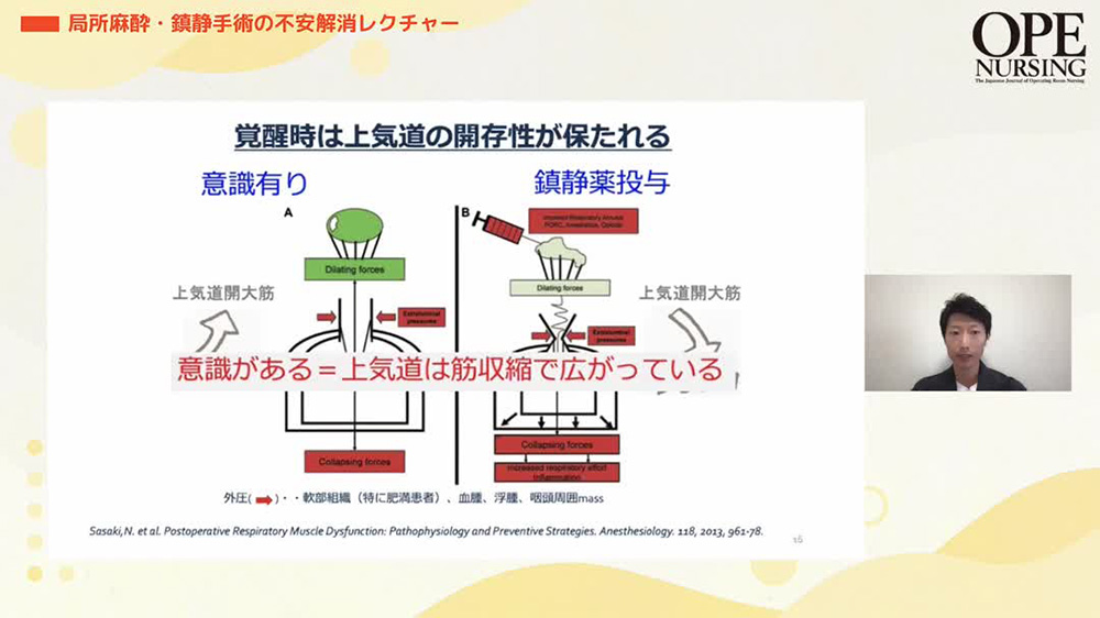 局所麻酔・鎮静手術の不安解消レクチャー 【オペナーシング25年10号付】
