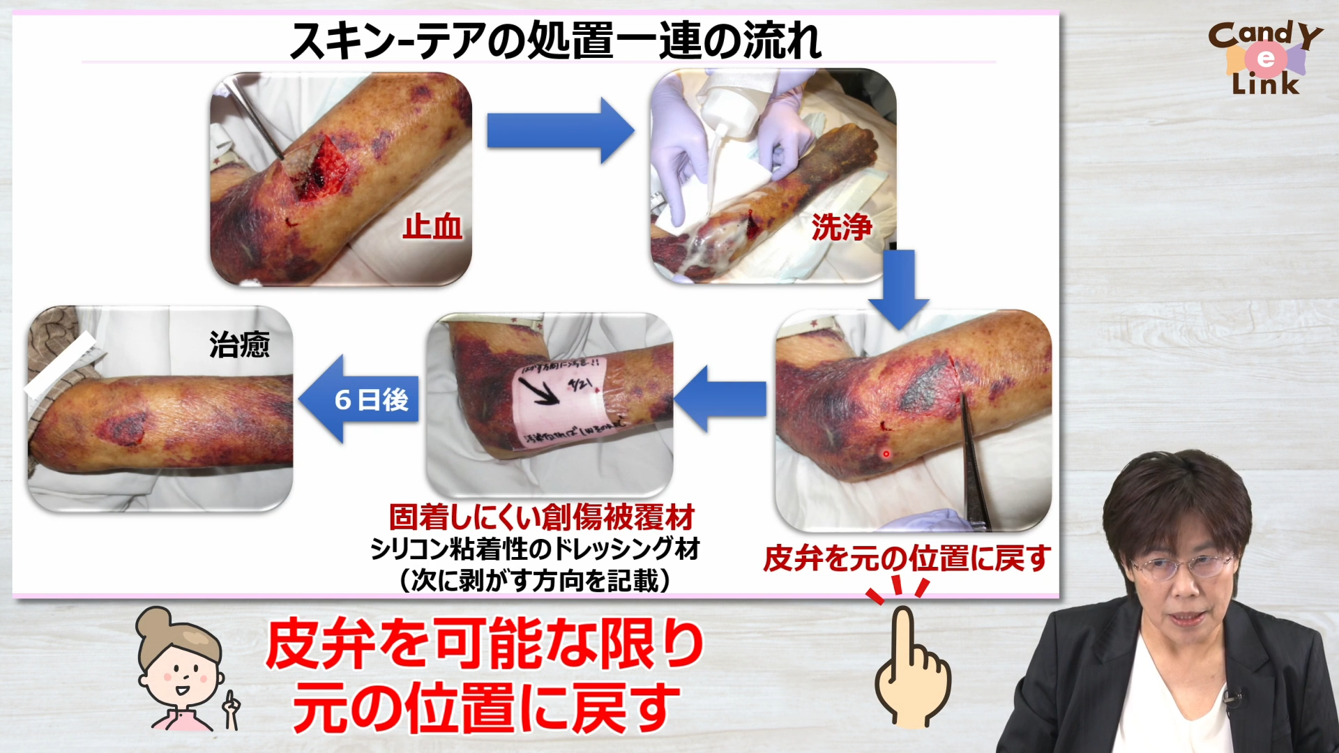 スキン-テアから高齢者を守る