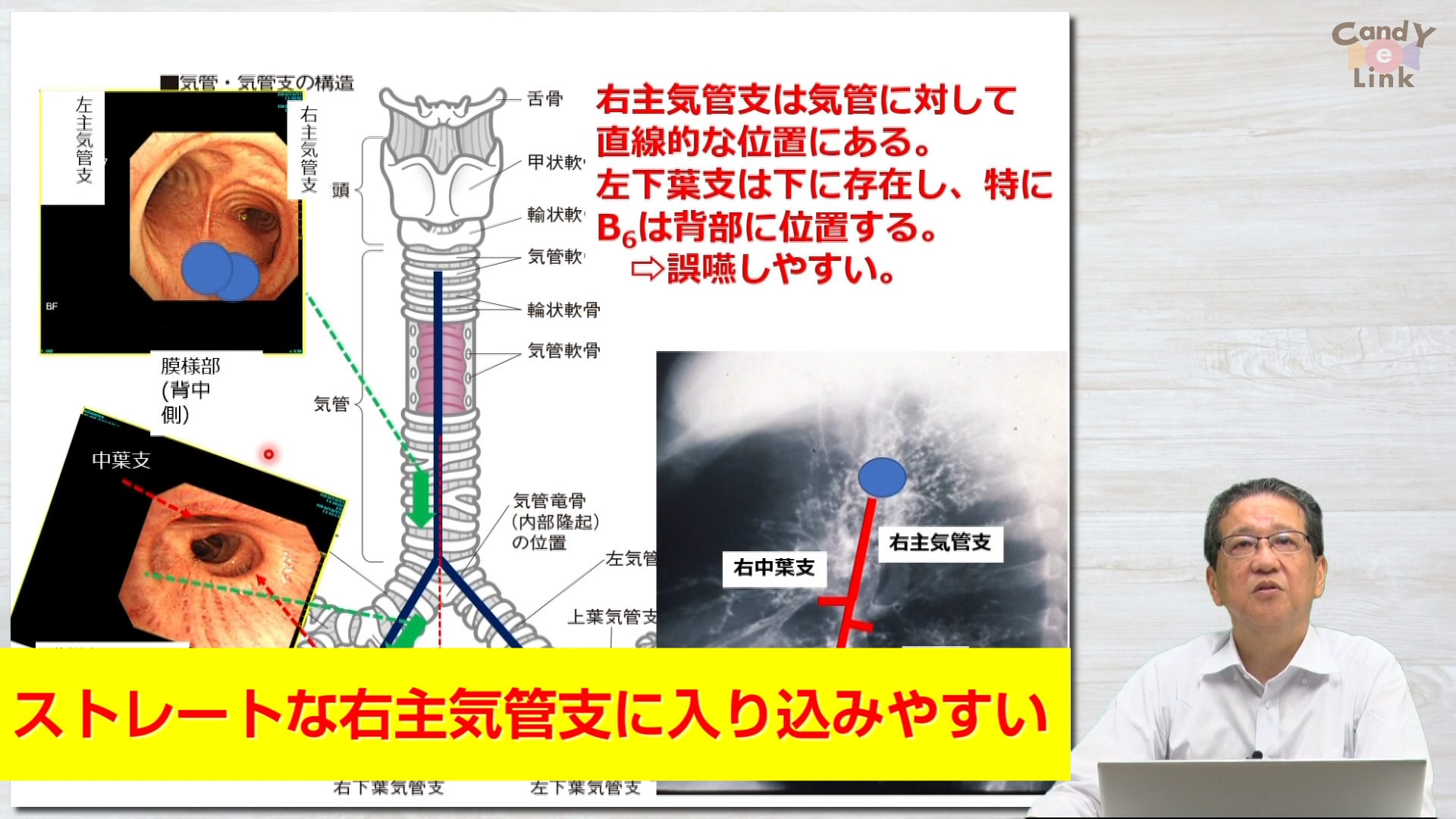 誤嚥性肺炎の病態生理と予防