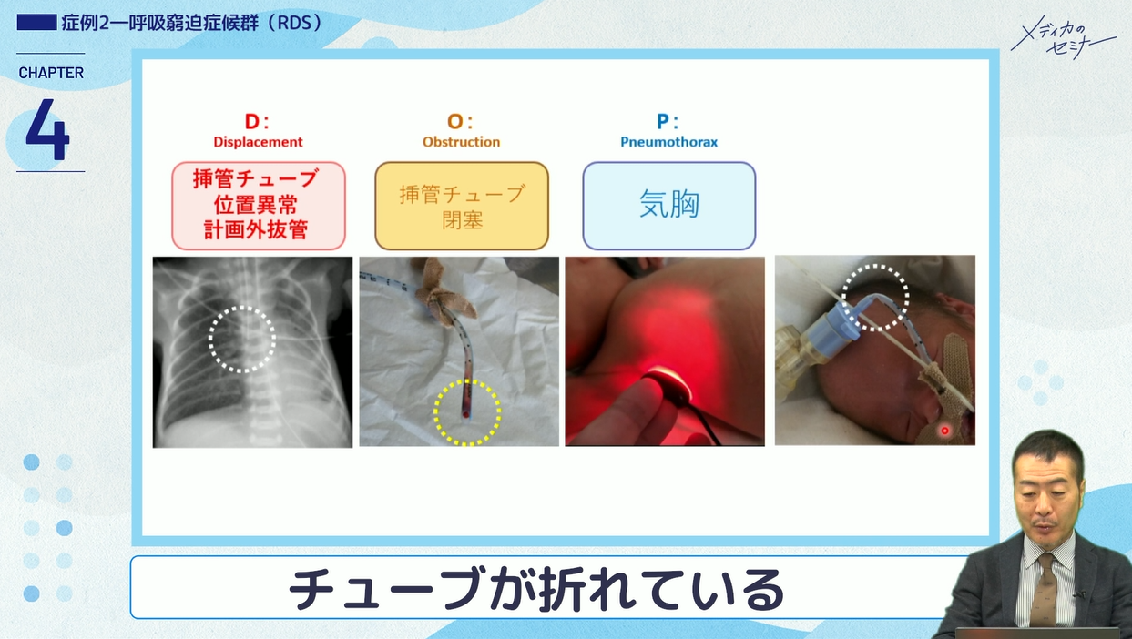 とことんやさしい 新生児呼吸管理　【スライド資料送付】