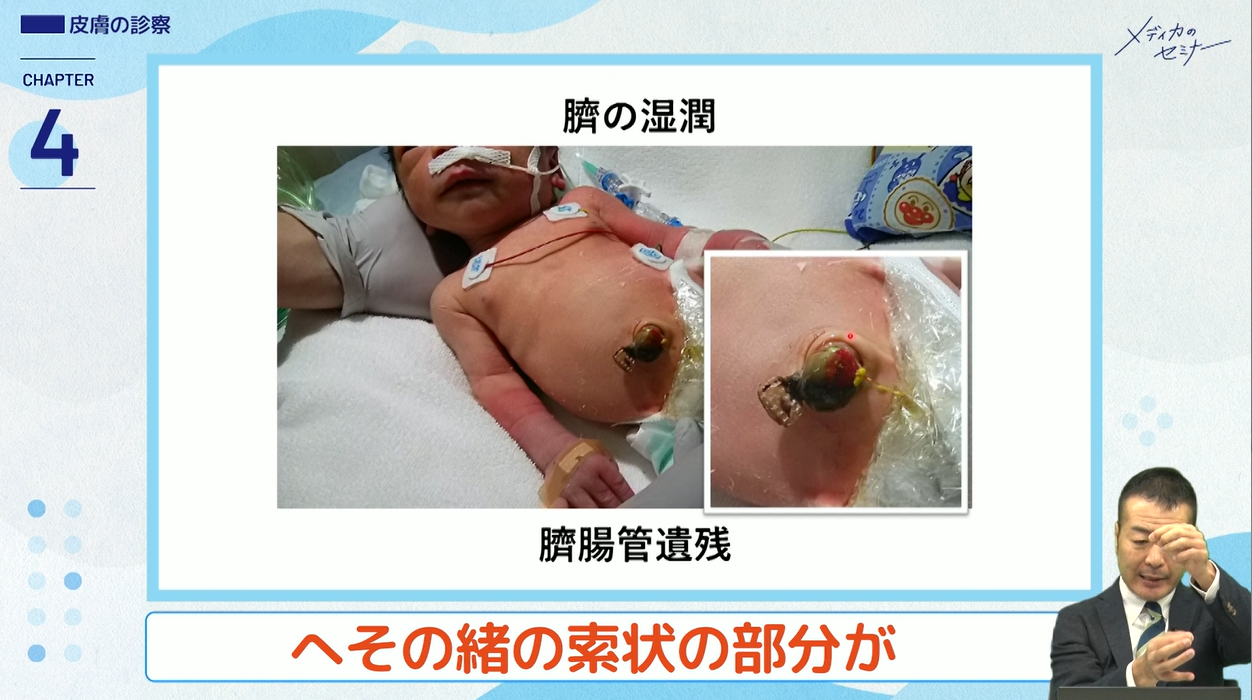 とことんやさしい 新生児のからだのみかた　【スライド資料送付】